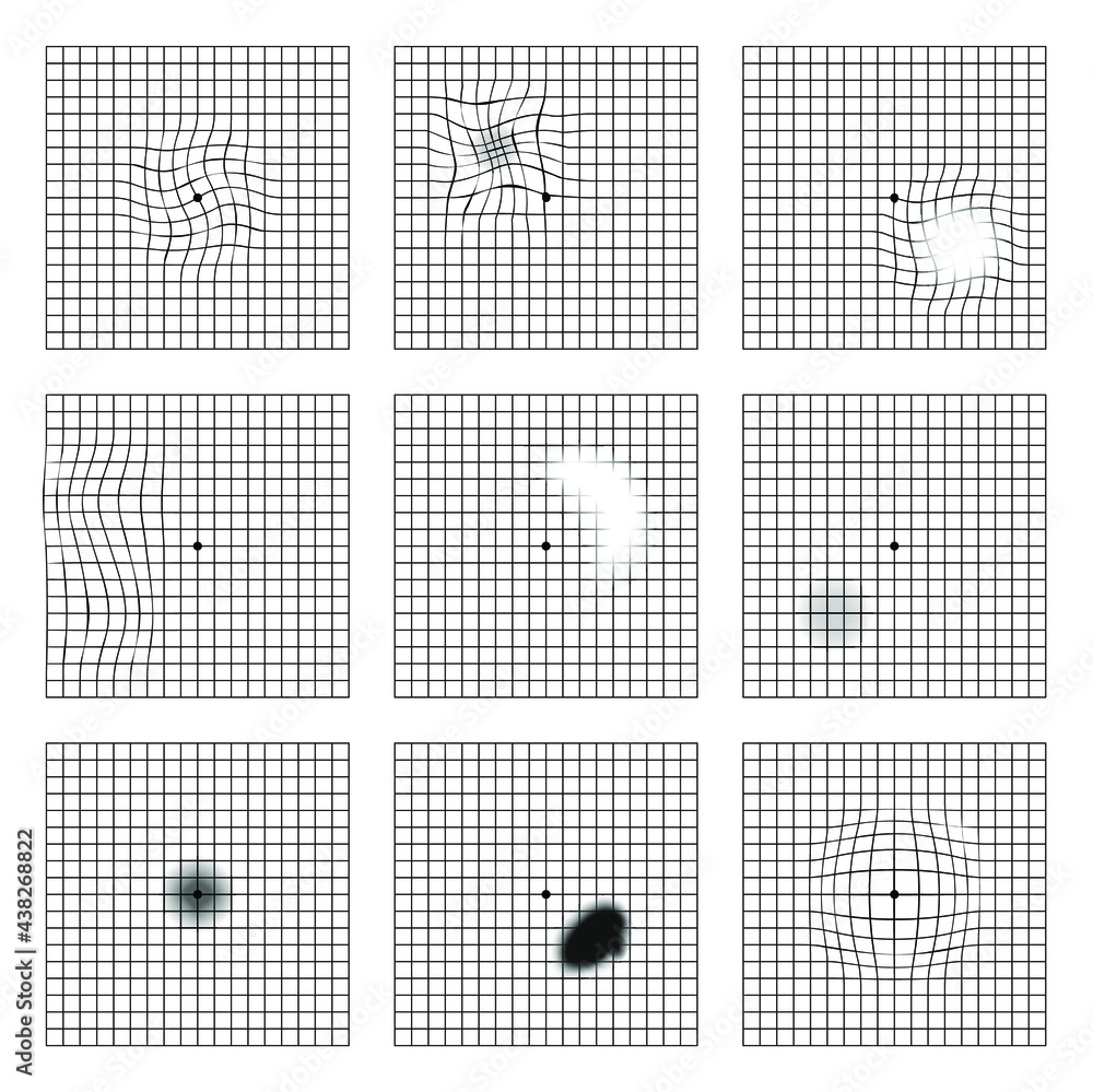 amsler grid printable amsler grid printable
